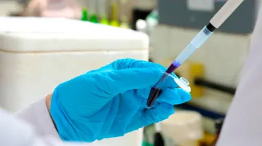 La UBA investiga cómo detectar el riesgo suicida con un análisis de sangre