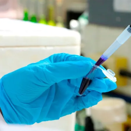 La UBA investiga cómo detectar el riesgo suicida con un análisis de sangre